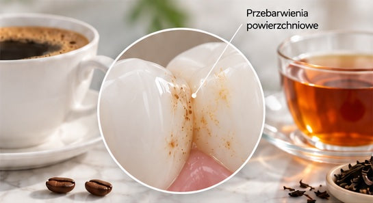 Ilustračný obrázok – zafarbenie